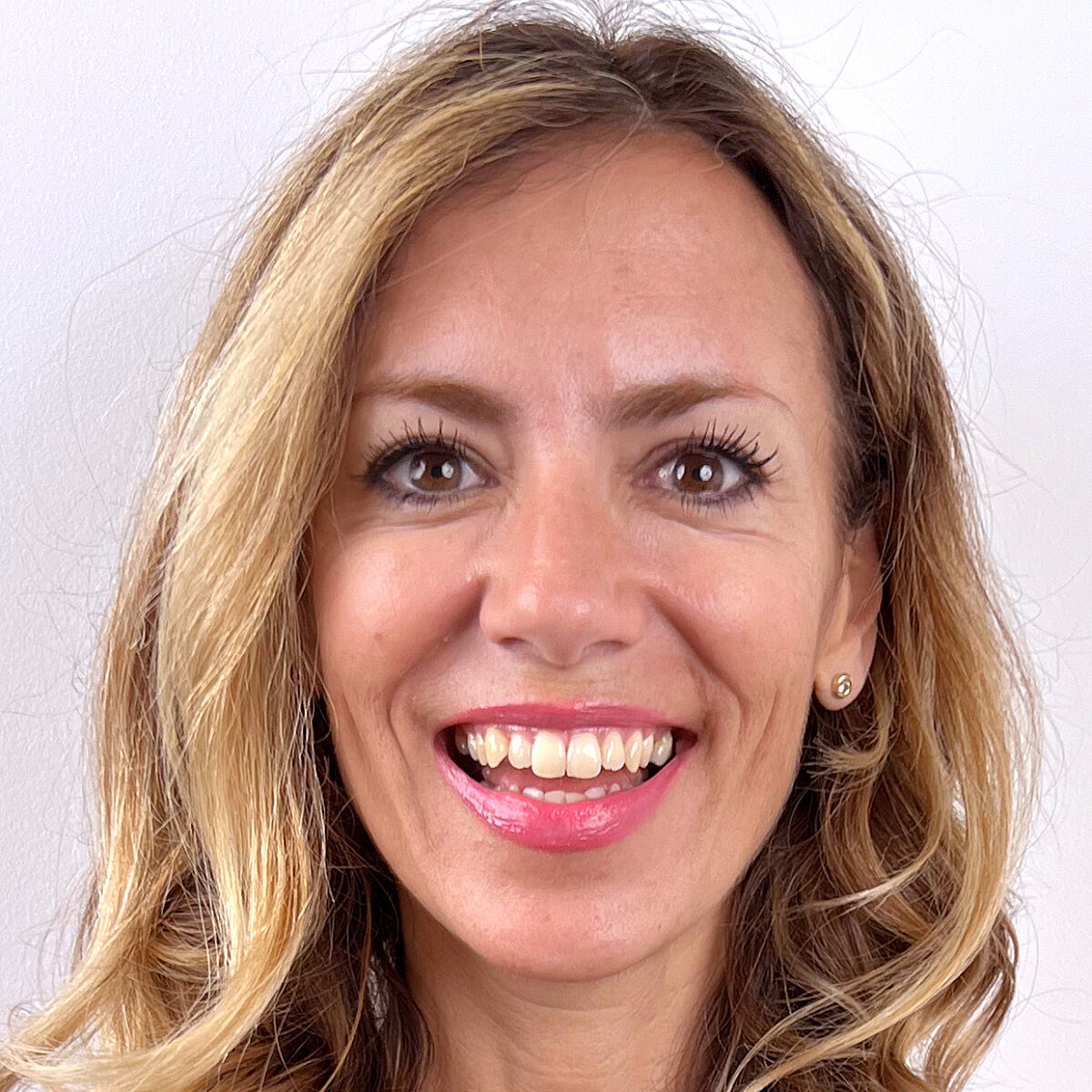 Portraitfoto von Silvana nach einer ästhetischen Geschichtsbehandlung bei Smoothline.