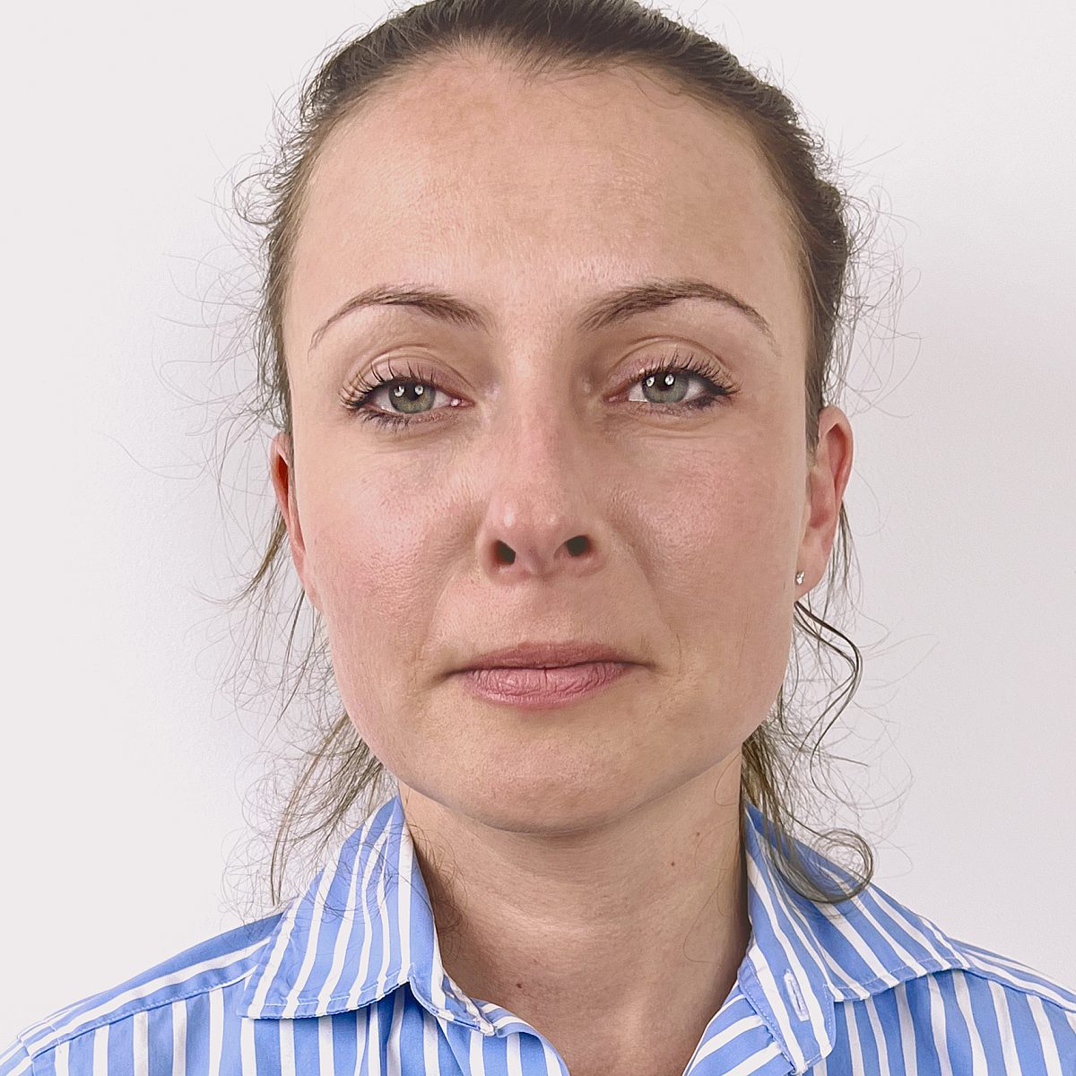 After-photo of Ekaterina without frown lines