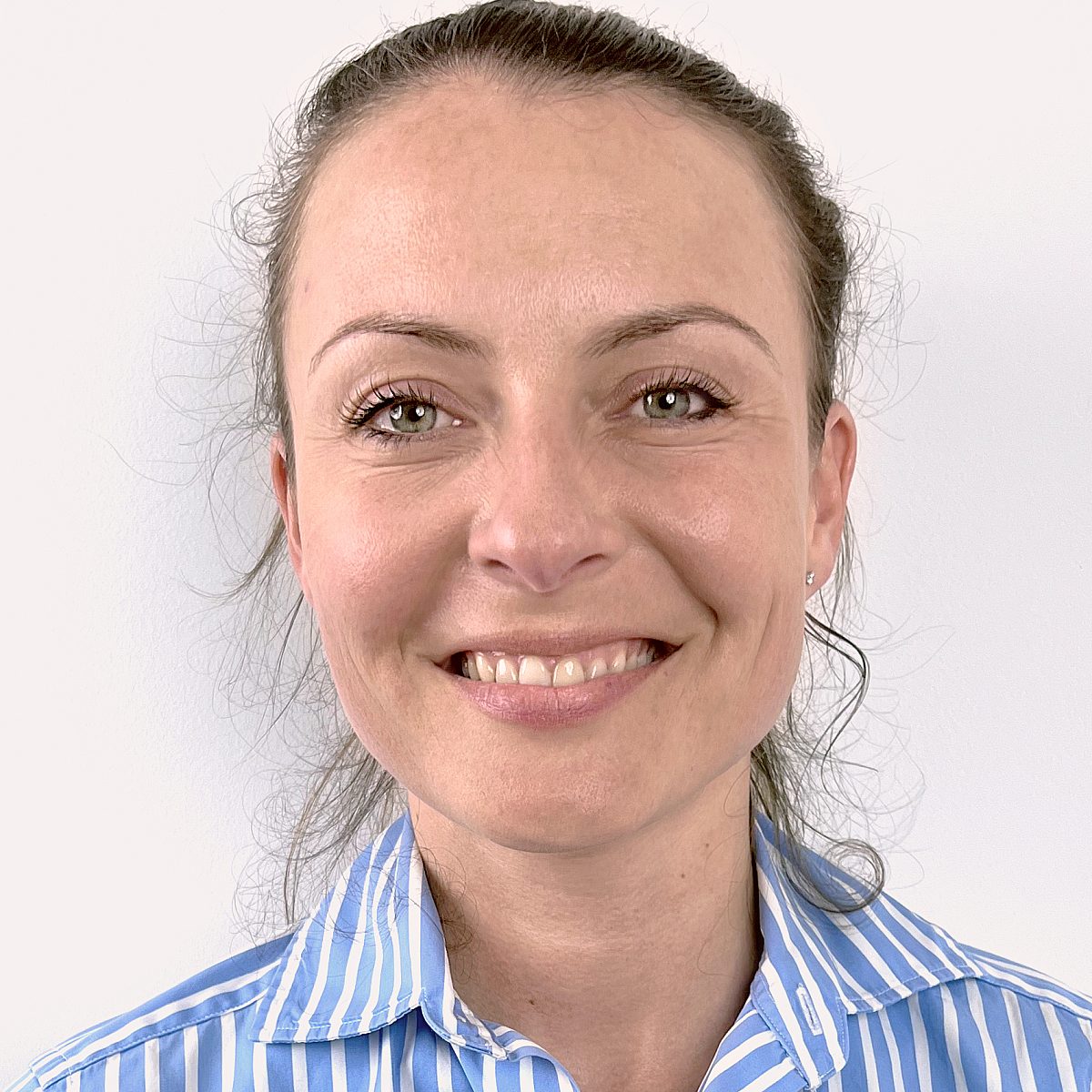 After-photo of Ekaterina with fewer laugh lines around the eyes