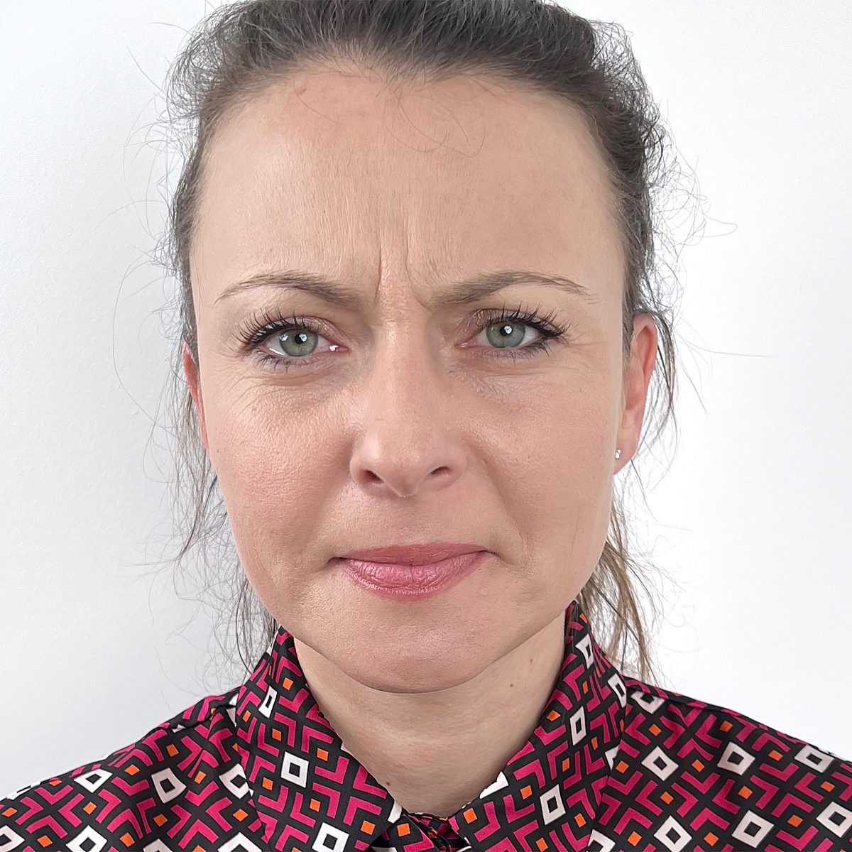 Portrait of Ekaterina before treatment at Smoothline