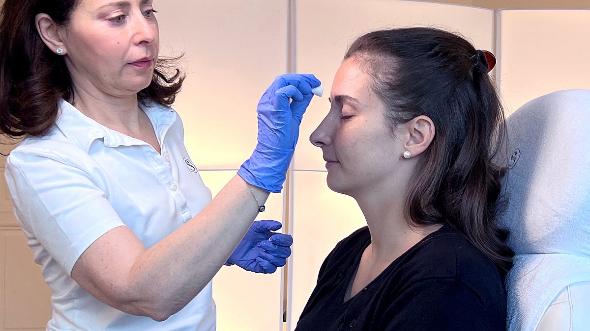 Photo of Olga Juri, MD, disinfecting the areas to be treated on Marta's face.