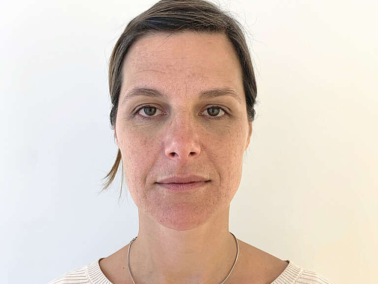Portraitfoto von Manuela vor ihrer Gesichtsbehandlung bei Smoothline in Zürich