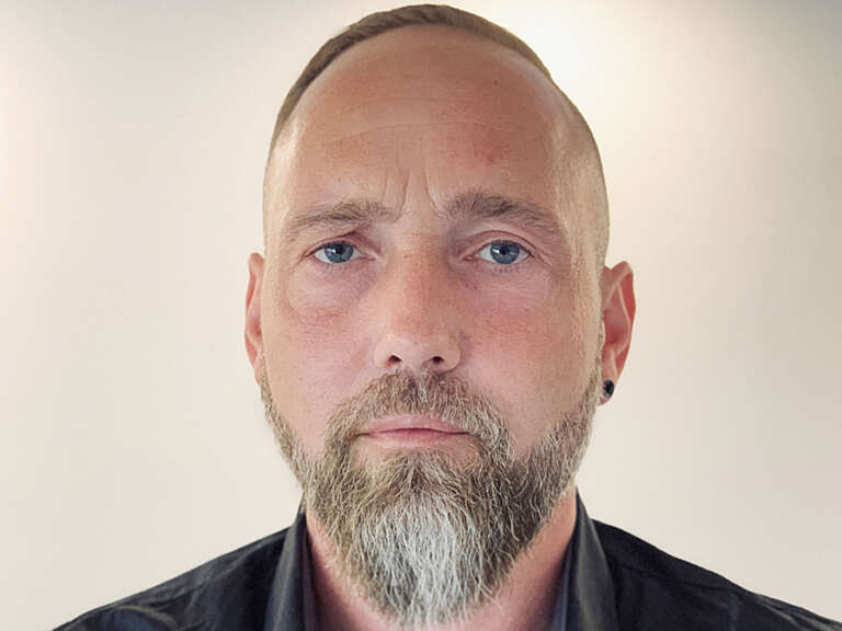 Portrait photo of Matthias before the holistic facial treatment with botulinum and filler at Smoothline