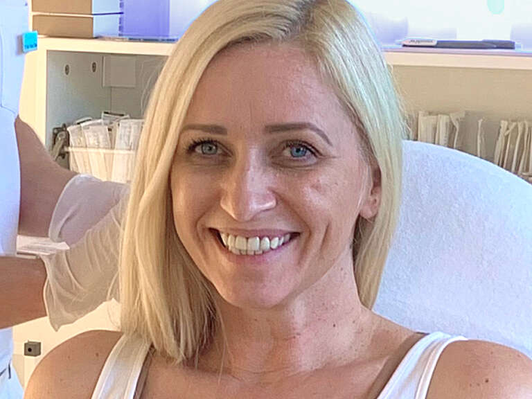 Portrait photo of Sabrina before her treatment at Smoothline